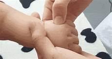 小儿推拿咳嗽